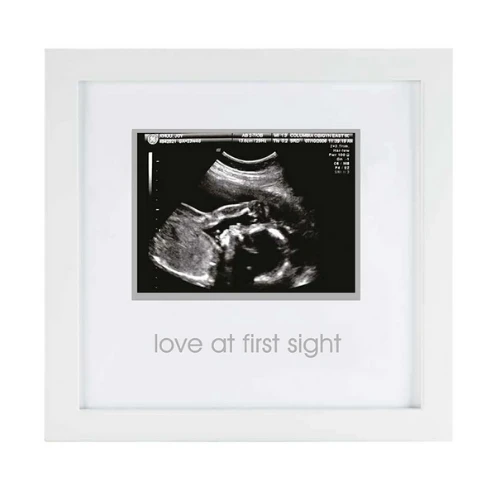 Pearhead Sonogram Frame 3 Pearhead Sonogram Frame